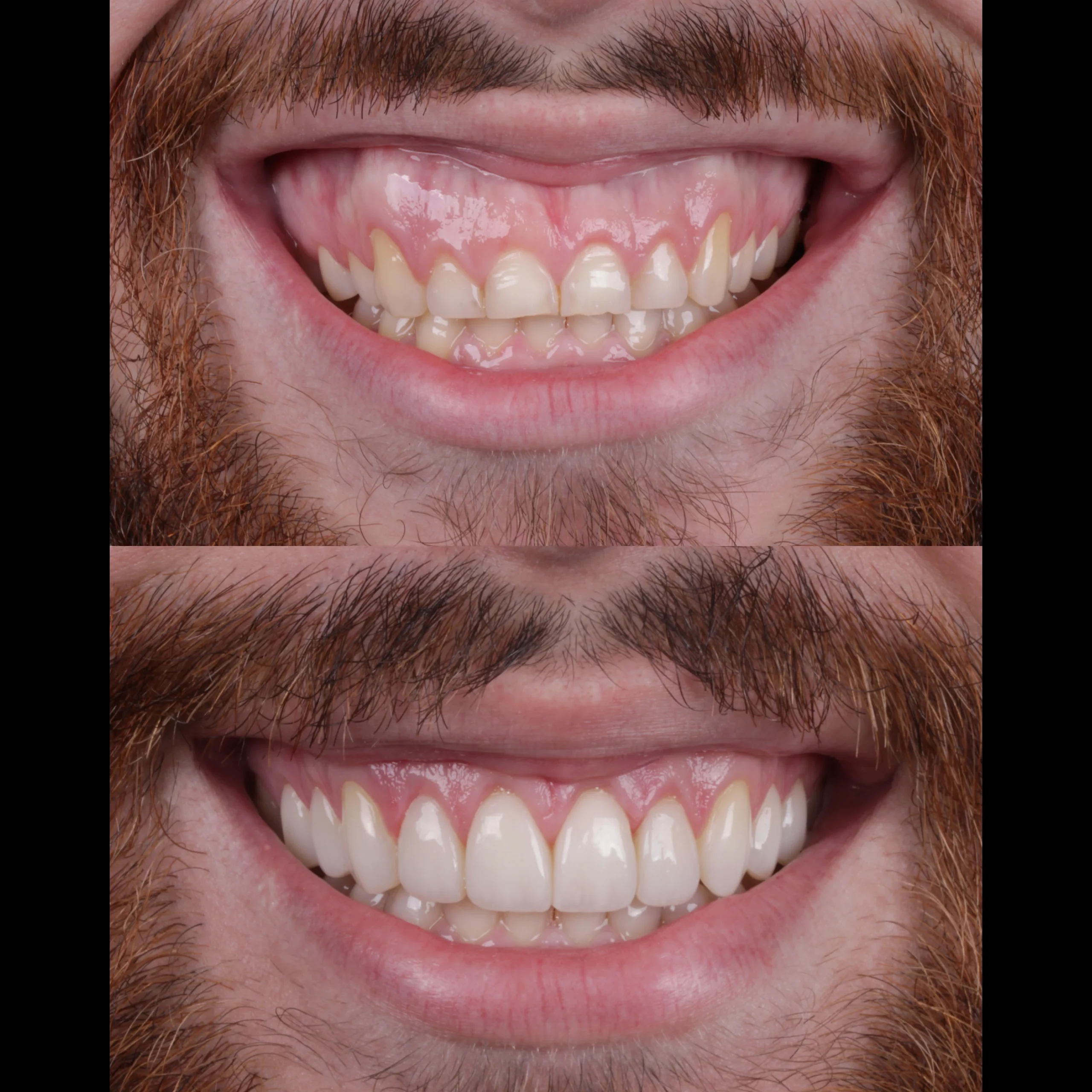 dental-10