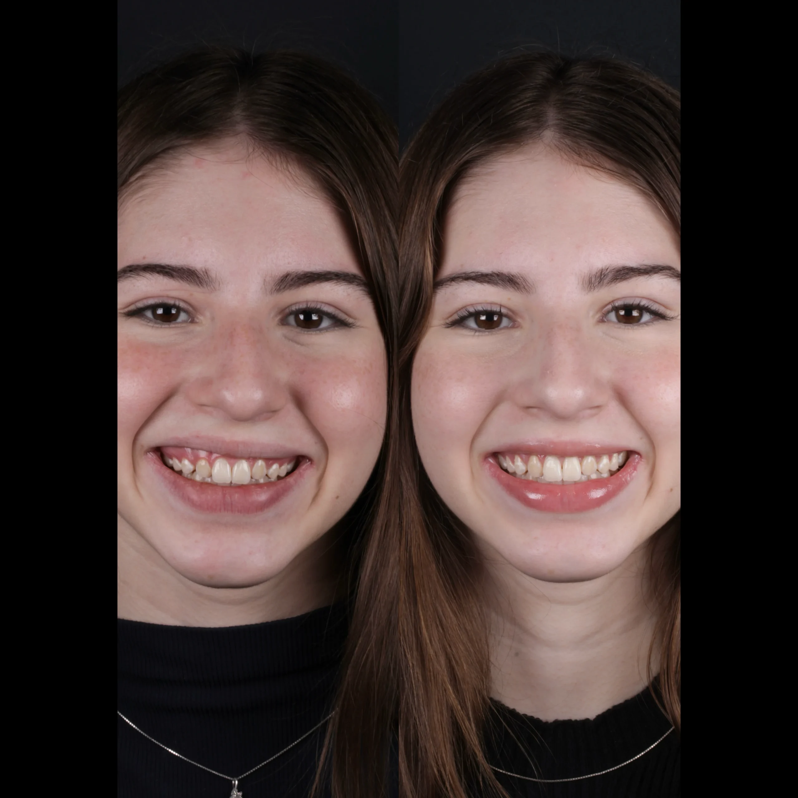 dental-11