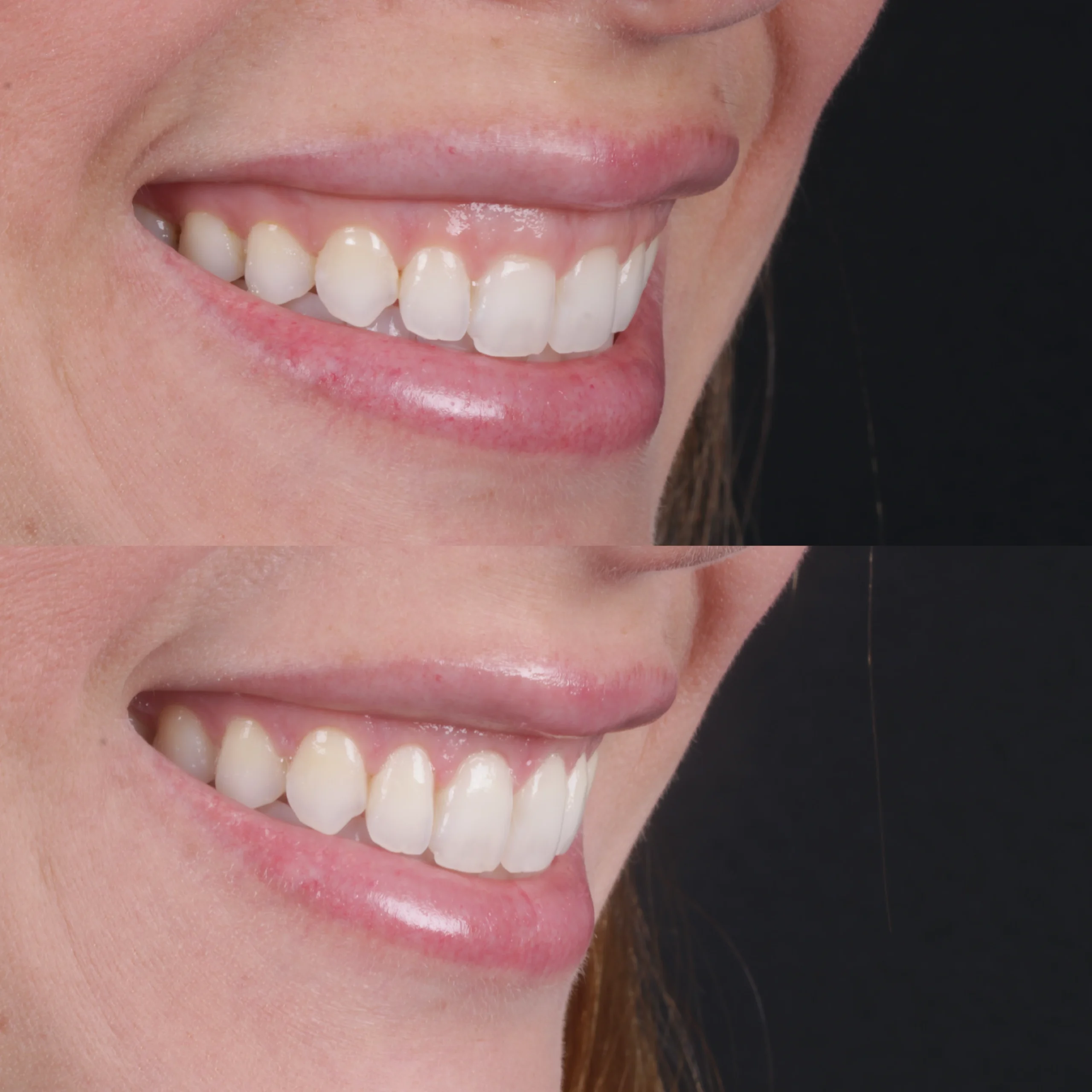 dental-13