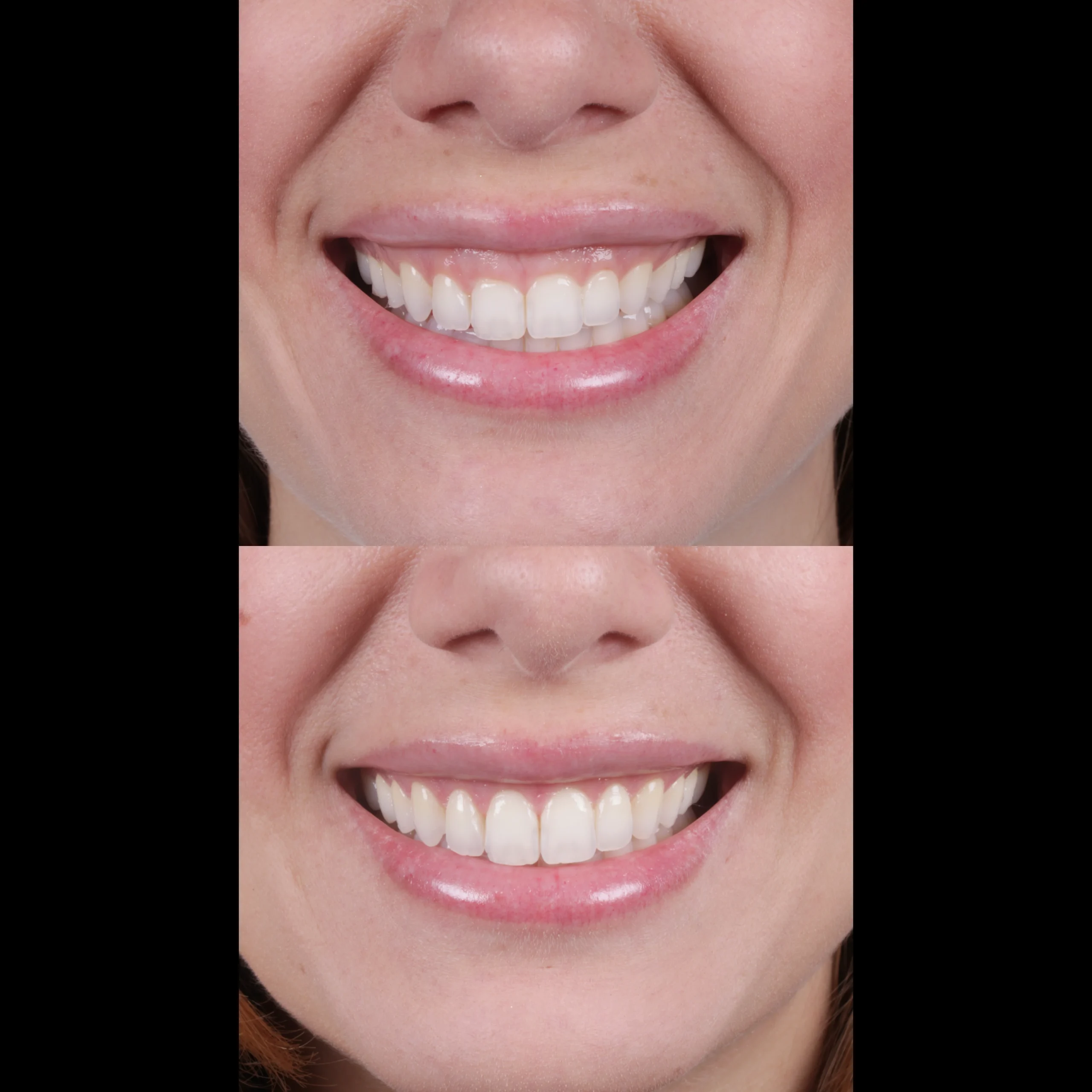 dental-14