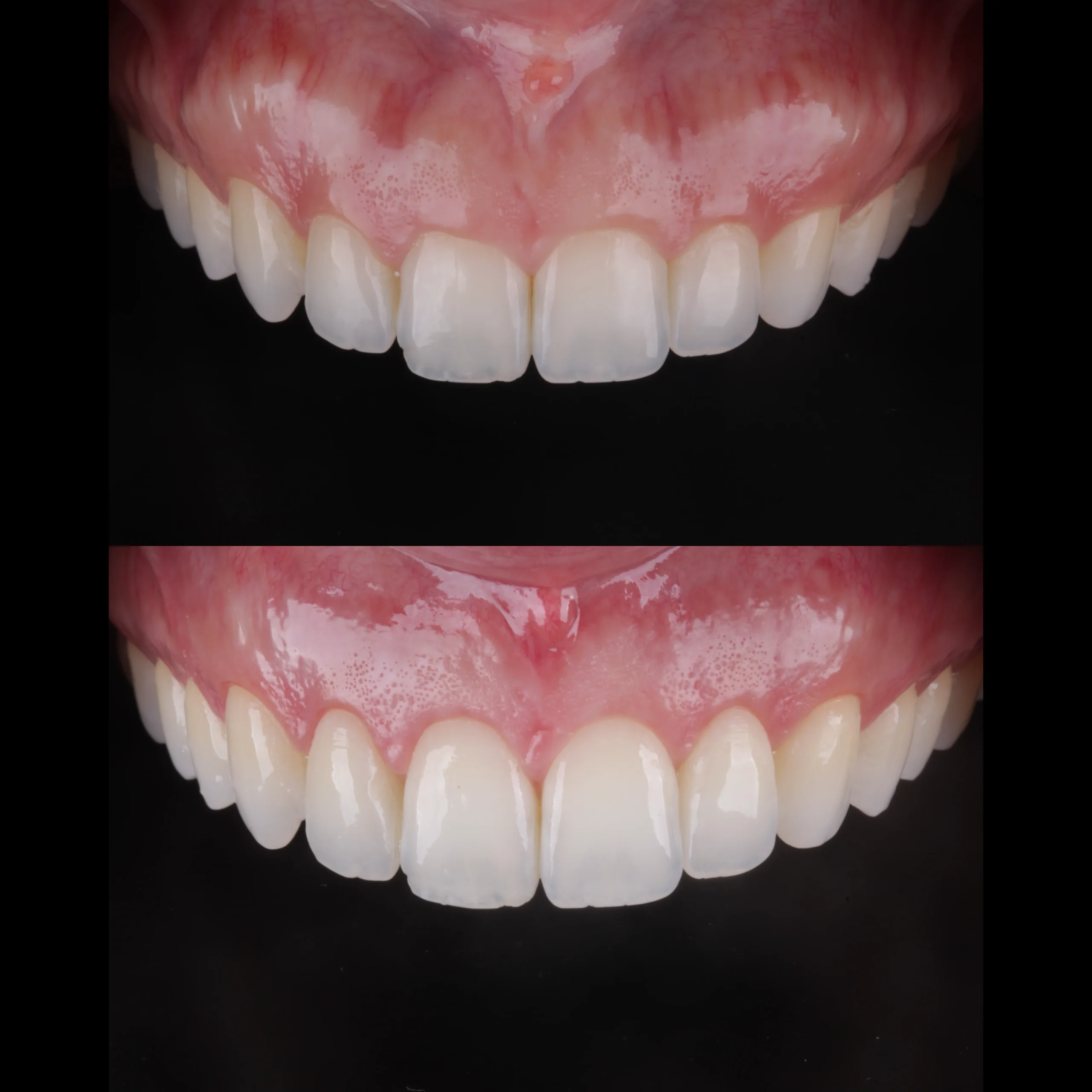 dental-15