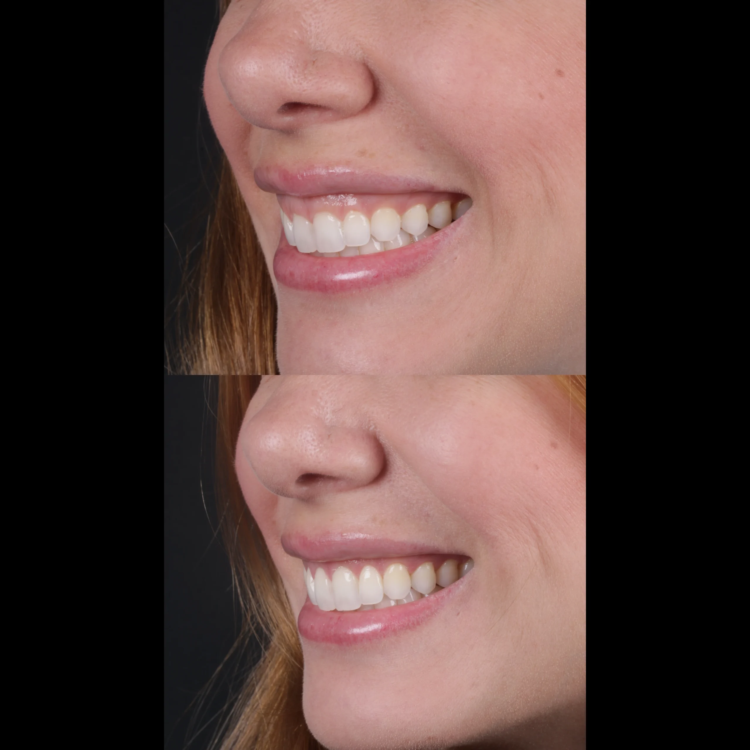 dental-16