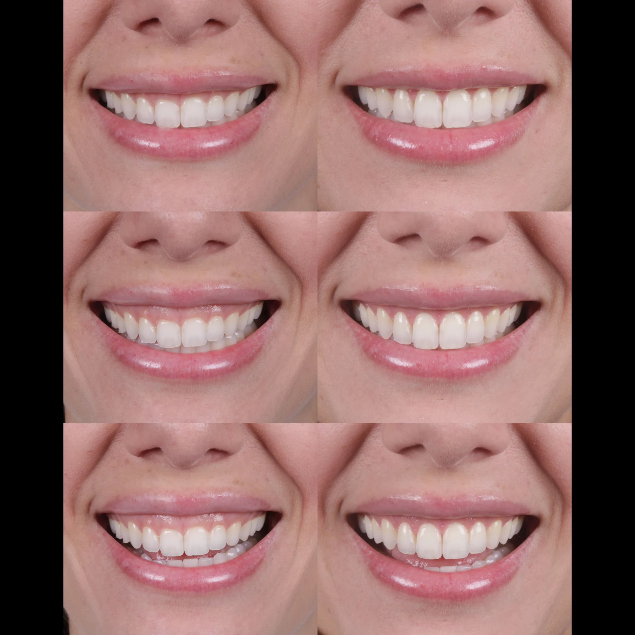 dental-17