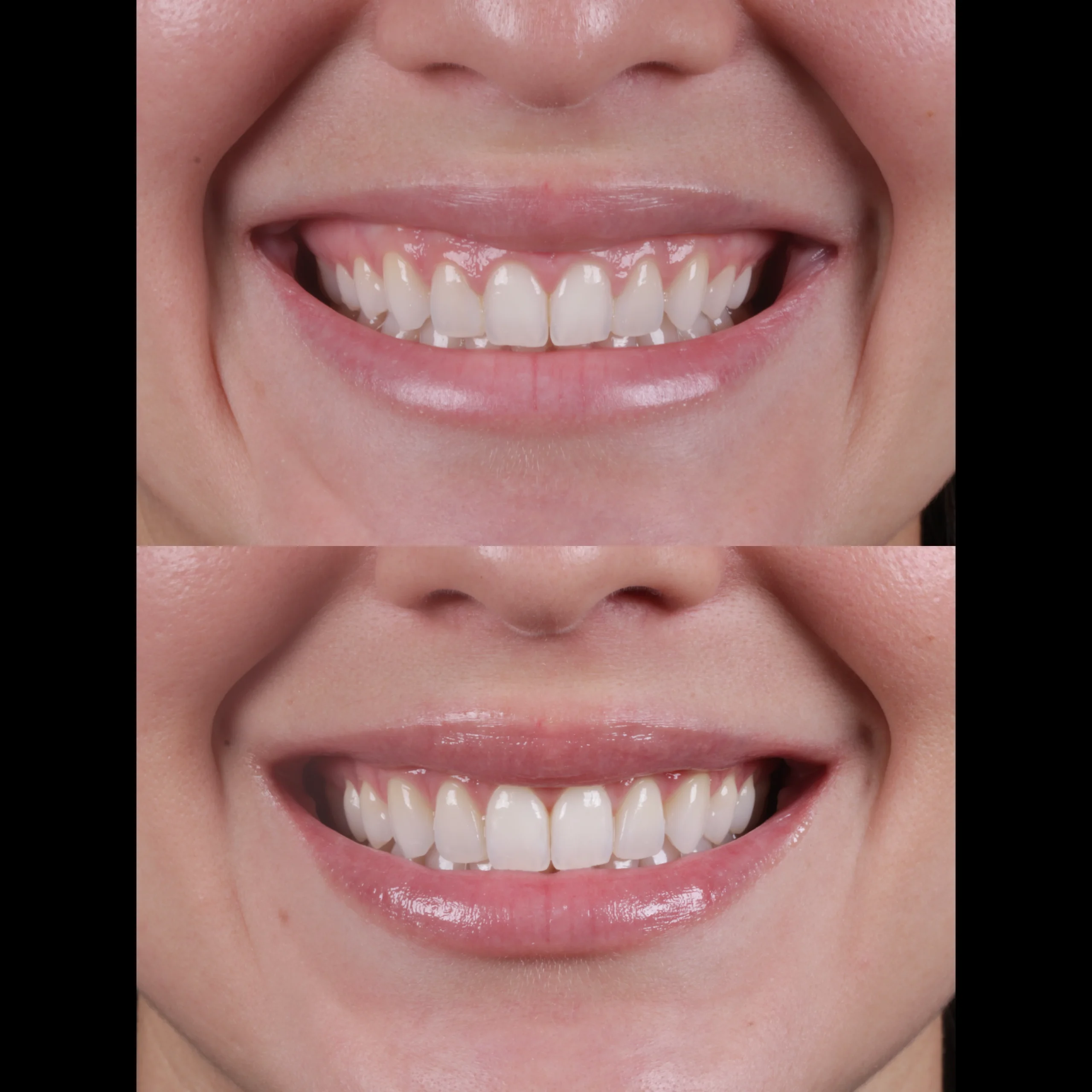 dental-19