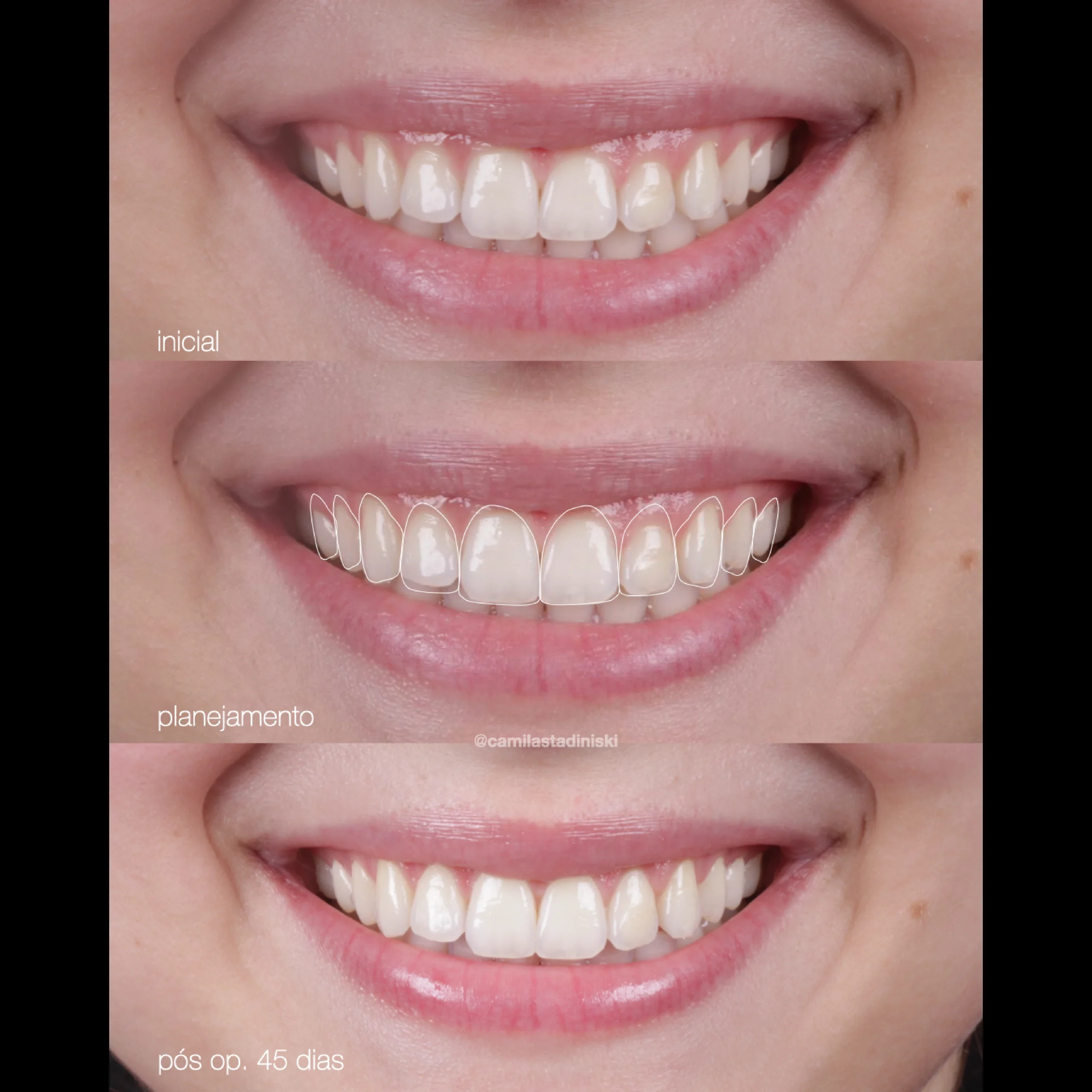 dental-20