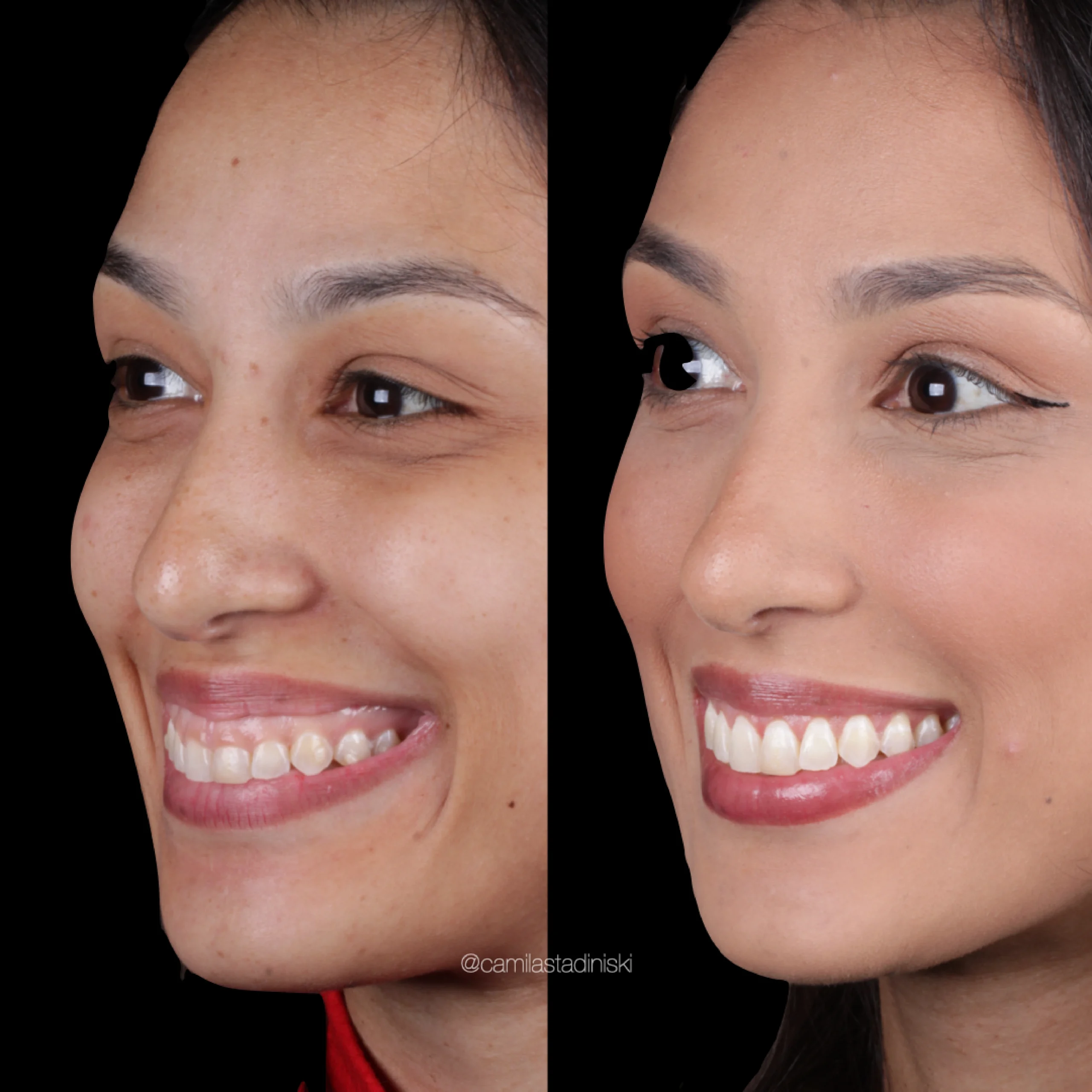 dental-28