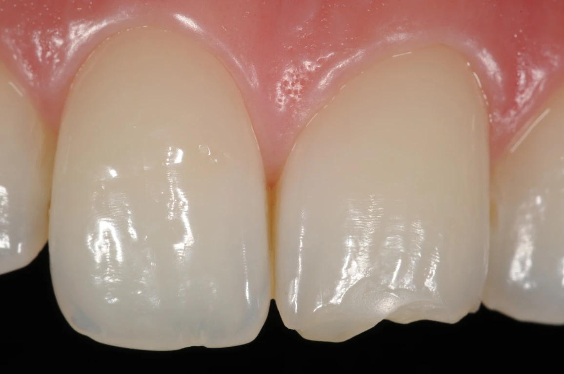 fig 01