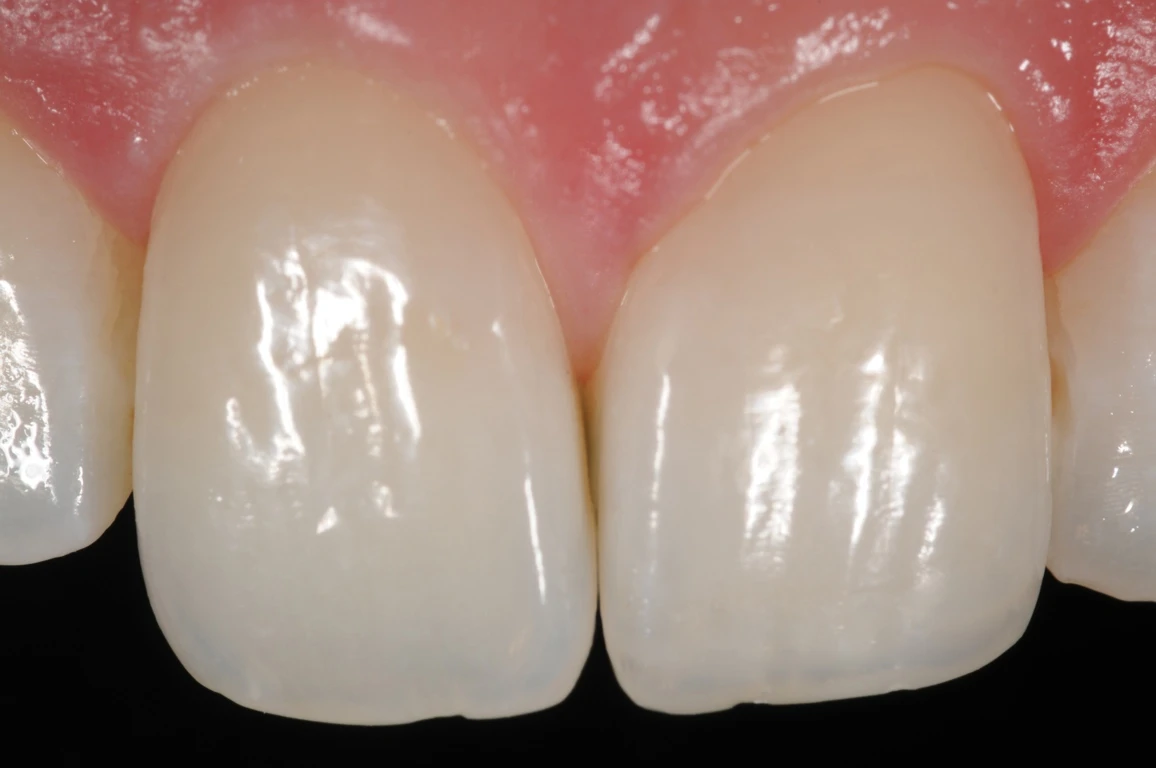 fig 21