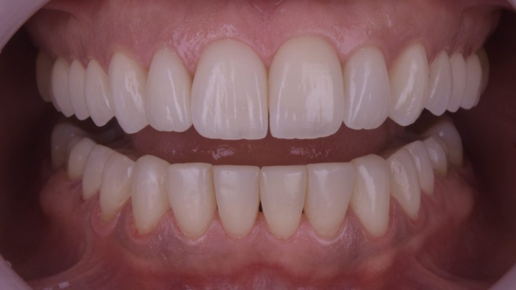 dental simulation.001