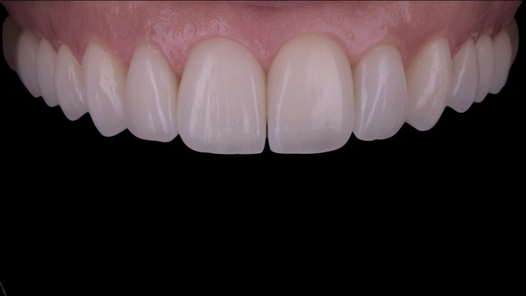 dental simulation.002