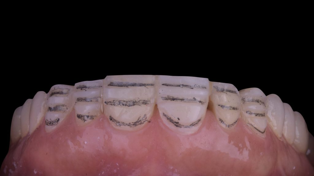 dental simulation.004