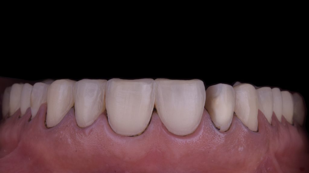 dental simulation.005