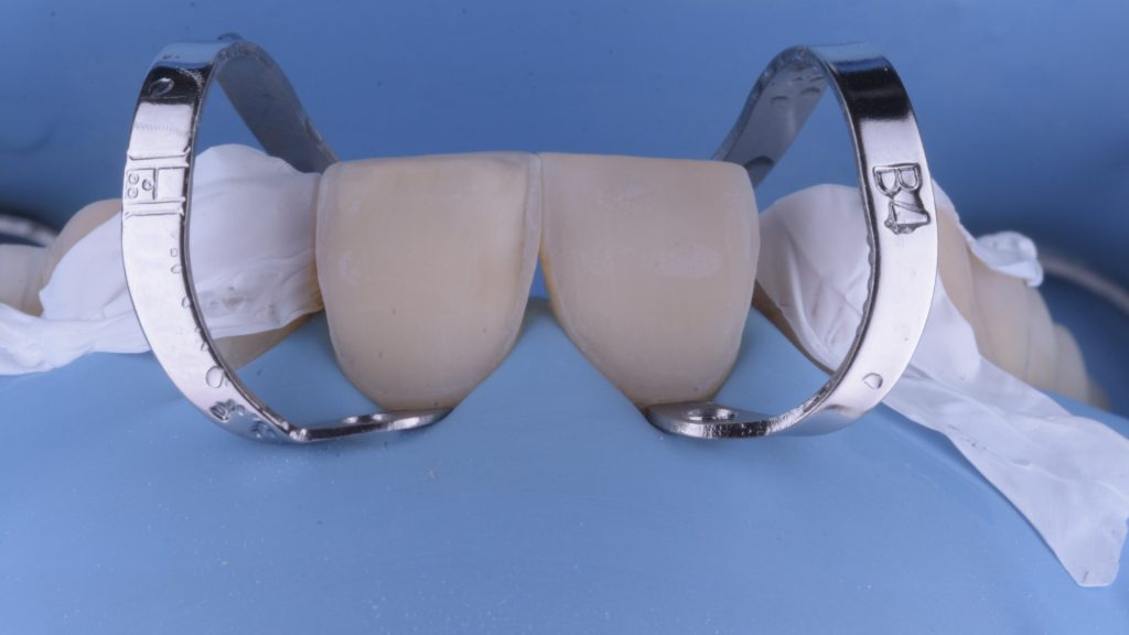 dental simulation.006