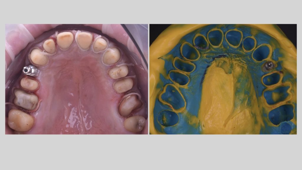 dental simulation.008