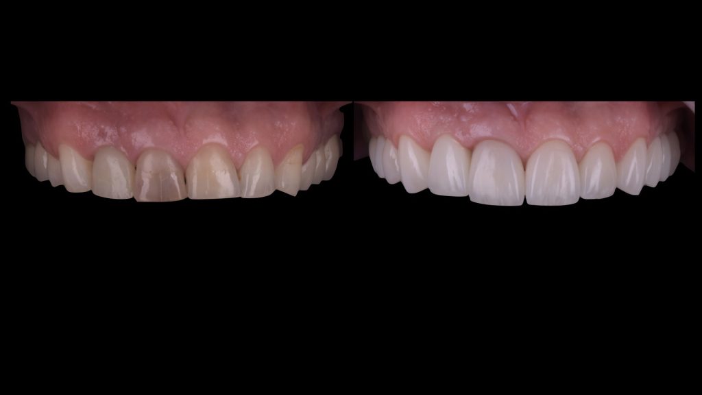 dental simulation.009